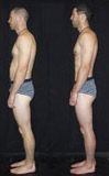 before and after rolfing